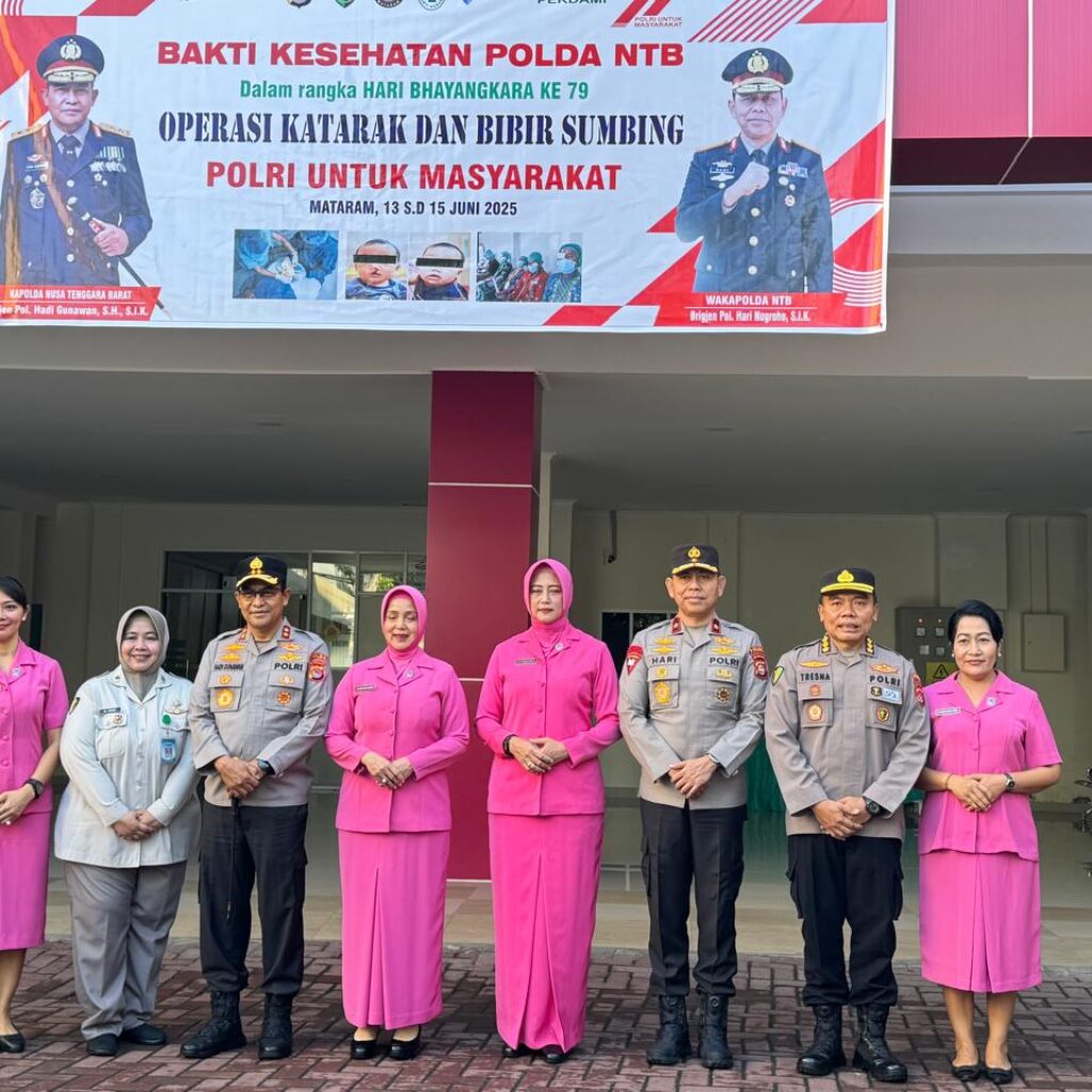 Sambut Hari Bhayangkara ke-79, Polda NTB Gelar Operasi Katarak dan Bibir Sumbing Gratis di RS Bhayangkara